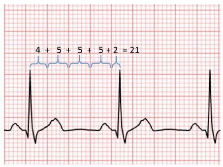 Método del 1500 para calcular la frecuencia cardíaca